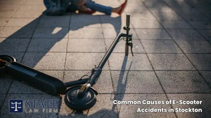 E-Scooter Accident Attorney Stockton | Get Expert Legal Help