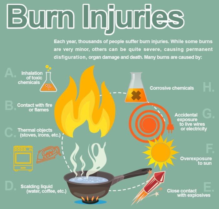Burn Injury Lawyer | Omaha, NE | Free Consultation